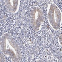 Anti-TMX1 antibody produced in rabbit 