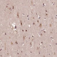 Anti-TMX2 antibody produced in rabbit HPA063763-100UL