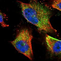Anti-TNPO3 antibody produced in rabbit 