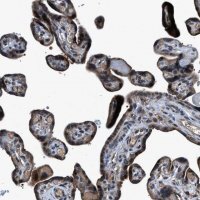Anti-TNRC18 antibody produced in rabbit 