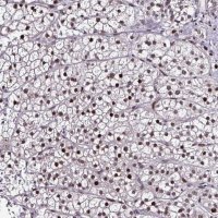 Anti-TOB1 antibody produced in rabbit