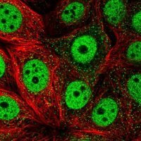 Anti-TOB1 antibody produced in rabbit