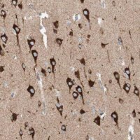 Anti-TOMM20 antibody produced in rabbit 