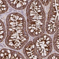 Anti-TOMM40 antibody produced in rabbit 