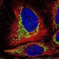 Anti-TOMM5 antibody produced in rabbit 