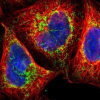 Anti-TOP1MT antibody produced in rabbit