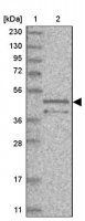 Anti-TOR3A antibody produced in rabbit
