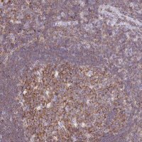 Anti-TPRG1 antibody produced in rabbit 