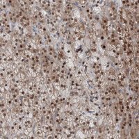 Anti-TPRKB antibody produced in rabbit 