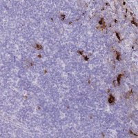 Anti-TPSB2 antibody produced in rabbit 