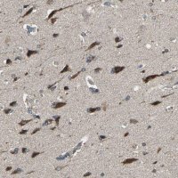Anti-TRAK1 antibody produced in rabbit 