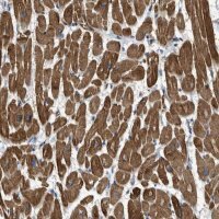 Anti-TRAK2 antibody produced in rabbit 