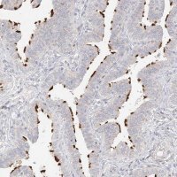 Anti-TRANK1 antibody produced in rabbit 
