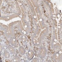 Anti-TRANK1 antibody produced in rabbit 