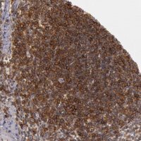 Anti-TRIB2 antibody produced in rabbit 