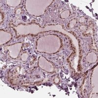 Anti-TRIB3 antibody produced in rabbit 