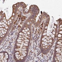 Anti-TRIM14 antibody produced in rabbit