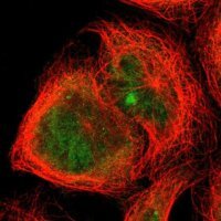 Anti-TRIM25 antibody produced in rabbit 