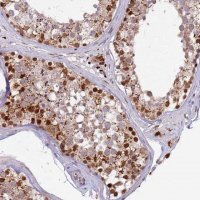 Anti-TRIM27 antibody produced in rabbit 