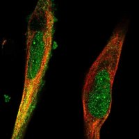 Anti-TRIM36 antibody produced in rabbit 