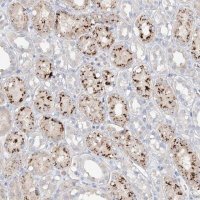 Anti-TRIM47 antibody produced in rabbit 