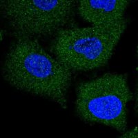 Anti-TRIM47 antibody produced in rabbit 