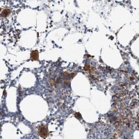 Anti-TRIM58 antibody produced in rabbit 