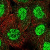 Anti-TRIM66 antibody produced in rabbit