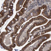 Anti-TRIM68 antibody produced in rabbit 