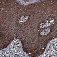 Anti-TRIM7 antibody produced in rabbit 