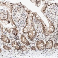 Anti-TRMT12 antibody produced in rabbit 