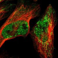 Anti-TRMT12 antibody produced in rabbit 