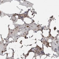 Anti-TRMT13 antibody produced in rabbit 