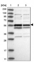 Anti-TRMT13 antibody produced in rabbit 