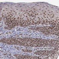 Anti-TRMT2A antibody produced in rabbit 