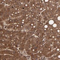 Anti-TROVE2 antibody produced in rabbit 
