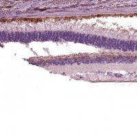 Anti-TRPM1 antibody produced in rabbit