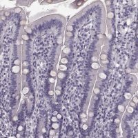 Anti-TRPM1 antibody produced in rabbit