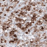 Anti-TSHB antibody produced in rabbit 