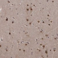 Anti-TSHZ2 antibody produced in rabbit 