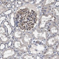 Anti-TSPAN33 antibody produced in rabbit 