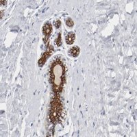 Anti-TSPAN6 antibody produced in rabbit 