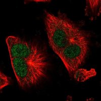 Anti-TSR1 antibody produced in rabbit 
