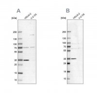 Anti-TTC19 antibody produced in rabbit 
