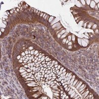 Anti-TTC19 antibody produced in rabbit 