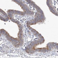 Anti-TTC21B antibody produced in rabbit 
