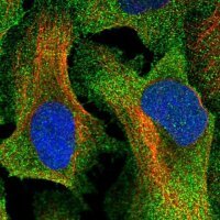 Anti-TTC23 antibody produced in rabbit 