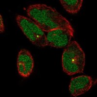 Anti-TTC30A antibody produced in rabbit
