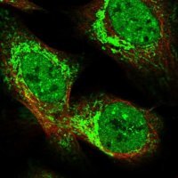 Anti-TTC32 antibody produced in rabbit