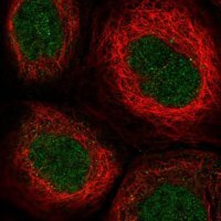 Anti-TTC33 antibody produced in rabbit 
